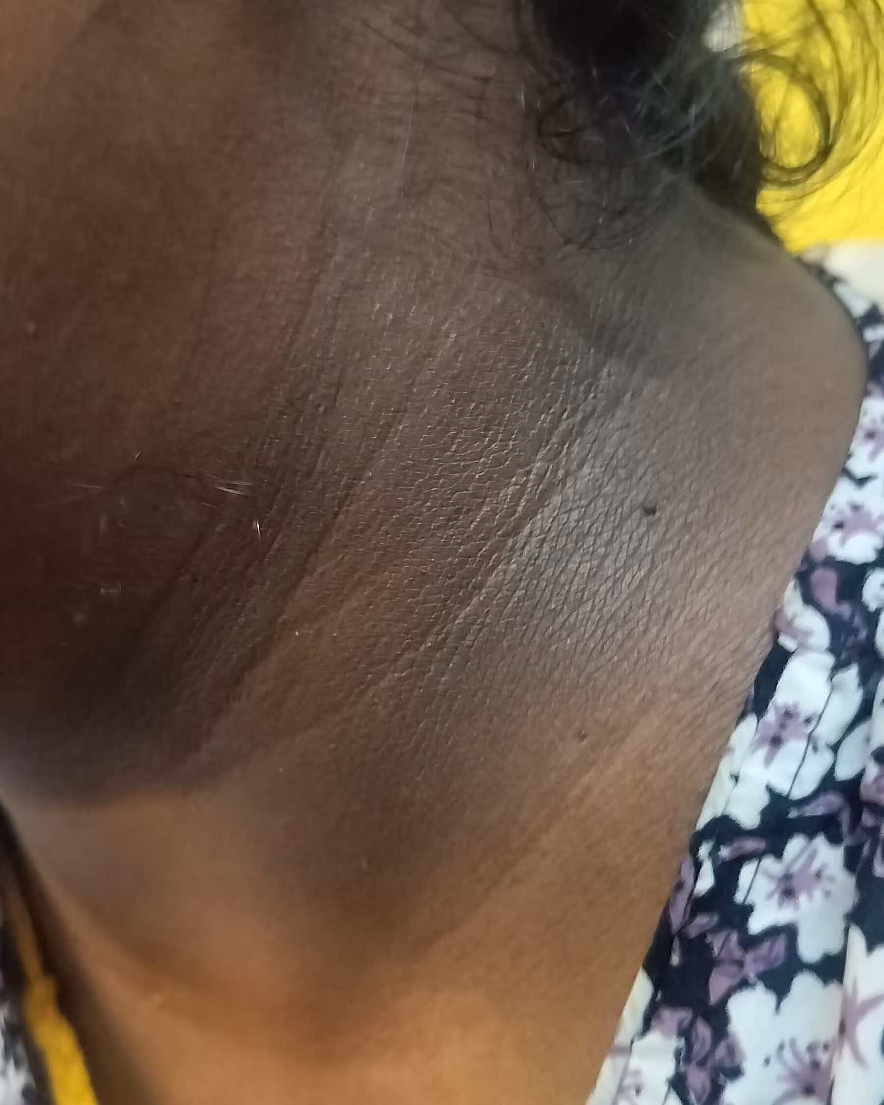 Before — Kavitha