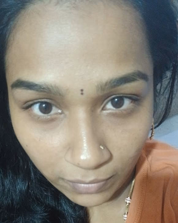 After — Prema